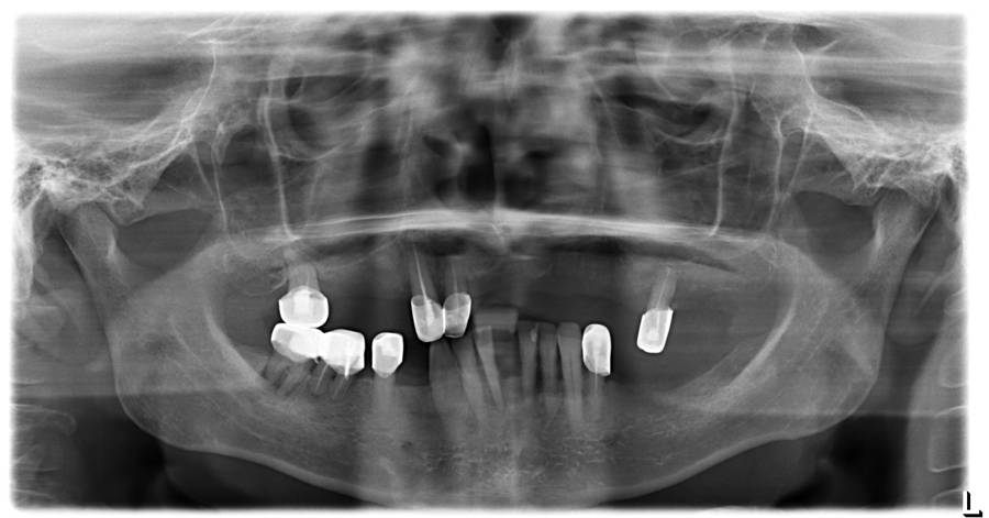 пациент V