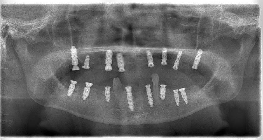 пациент V